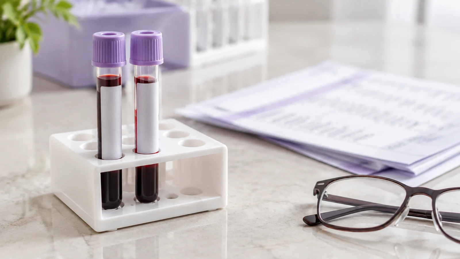 Tubos de coleta e exames representam a investigação hormonal
